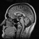 [Thom's brain]